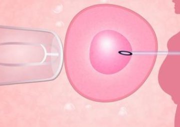 确诊为免疫性不孕能在台湾省做试管婴儿吗？做三代试管需要多少钱？