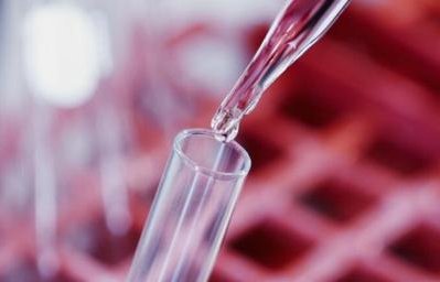 42岁怀孕要做哪些检查（42岁怀孕要做哪些检查确诊）