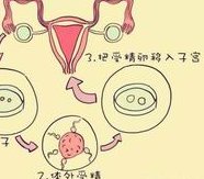 国内三代试管婴儿需要排队吗？